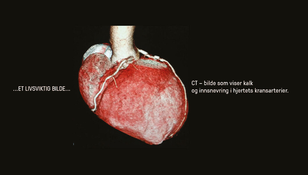 CT - bilde som viser kalk og innsnevringer i hjertets kransarterier. CT - bilde som viser kalk og innsnevringer i hjertets kransarterier.